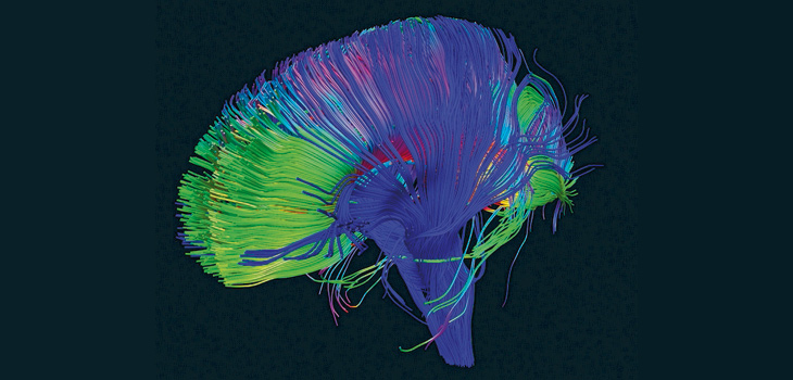 Vías neuronales del cerebro reconstruidas utilizando la tractografía, una técnica para modelar dt-MRI que resalta áreas de actividad y estructura del cerebro. / P. Basser - NICHD (FLICKR)