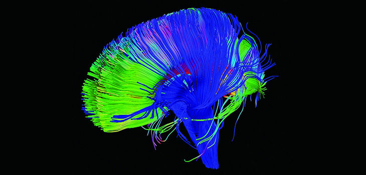 Vías neuronales del cerebro reconstruidas utilizando la tractografía, una técnica para modelar dt-MRI que resalta áreas de actividad y estructura del cerebro. / P. Basser - NICHD (FLICKR, CC BY 2.0)
