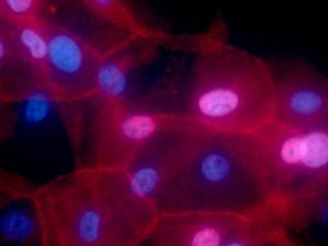 La imagen muestra el cultivo de células de cáncer de mama humano condicionalmente células reprogramadas. El color rojo de la fluorescencia representa el MHC-I, y los núcleos se muestran en azul. / Ewa Krawczyk (National Cancer Institute \ Georgetown Lombardi Comprehensive Cancer Center)