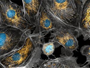 Células de vaca tomadas con un microscopio, las mitocondrias se tiñeron en amarillo brillante para visualizarlas en la célula. Los grandes puntos azules son los núcleos de las células y la red gris es el citoesqueleto de las células. / Torsten Wittmann, University of San Francisco/NIH Image Gallery (FLICKR)