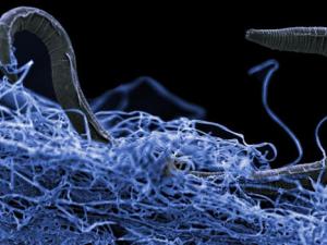 Un nematodo (eucariota) en una biopelícula de microorganismos. Este nematodo no identificado (Poikilolaimus sp.) De la mina de oro Kopanang en Sudáfrica, vive a 1,4 km por debajo de la superficie. / Imagen cortesía de Gaetan Borgonie (Extreme Life Isyensya, Bélgica)