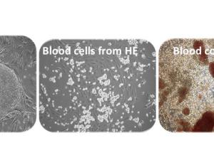 Generación de células sanguíneas humanas a partir de un único “endotelio hemogenico. / CERU-SRUK