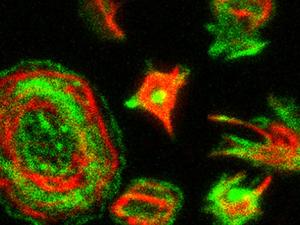 La mutación en MASTL produce defectos en la morfología de las plaquetas activadas, generando plaquetas anormales fusiformes junto a las plaquetas normales redondeadas. Las proteínas del citoesqueleto actina y tubulina aparecen marcadas en verde y rojo, respectivamente. /CNIO