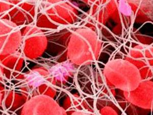 Imagen de microscopía de un trombo sanguíneo. / IQAC