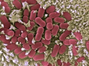 Imagen microscópica de la mucosa intestinal afectada por E. coli / (CNB/CSIC)