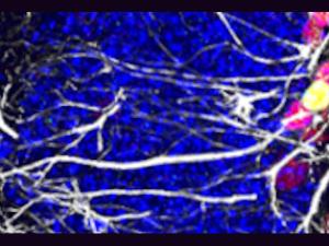 Descubren cómo reducir la pérdida de células madre relacionada con el envejecimiento en el cerebro de ratones