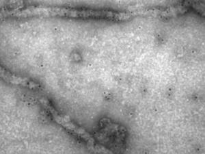 Detección mediante microscopía electrónica de partículas virales semejantes al virus del Ébola. / CSIC