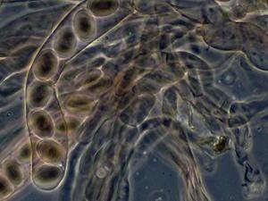 Microorganismo marino, Ascomycete fungus. / Peter G. Werner (WIKIPEDIA)