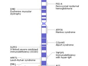 Ideograma del cromosoma X humano. / National Center for Biotechnology Information (WIKIMEDIA)