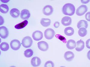 Micrografía de un frotis de sangre que contiene un microgametocito del parásito Plasmodium falciparum. / Content Providers(s): CDC/Dr. Mae Melvin Transwiki approved by: w:en:User:Dmcdevit (WIKIEMDIA)