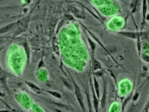 Micrografía de células madre embrionarias de ratón teñidas con un marcador fluorescente verde. / (WIKIMEDIA)