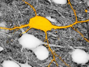 Imagen de la neurona etiquetada en amarillo, rodeada de neuronas no marcadas (aparecen en blanco), utilizando la técnica SUSHI. Sin esta técnica, las neuronas que aparecen en blanco no se verían.  / © Jan Tønnesen & Valentin Nägerl