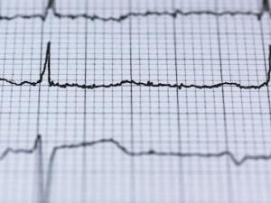 Las mujeres con un infarto tardan más que los hombres en llamar al médico