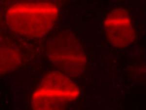 Proteína unida a las rupturas del ADN generadas con laser UV en células humanas, fotografía obtenida con microscopía de fluorescencia. 