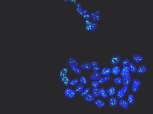 Núcleos de células metastáticas de cáncer de mama con la proteína MSK1 en verde. / Cristina Figueras-Puig, IRB Barcelona)