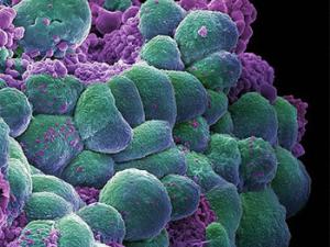 Conjunto de células de cáncer de mama. / Annie Cavanagh. images@wellcome.ac.uk (FLICKR)