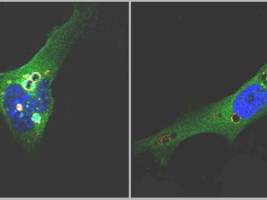 Células de ratón en presencia (izq.​) o en ausencia (dcha.) de la proteína DOR – dentro de las vesículas marcadas en naranja. Estos modelos han permitido descubrir el mecanismo por el cu ​al la proteína DOR regula a las células de la grasa y, de este modo, el desarrollo de la obesidad. / M. Romero (IRB Barcelona)