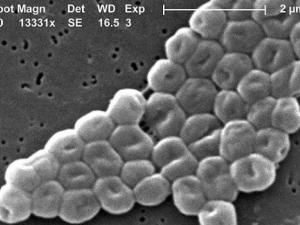Bacteria Acinetobacter baumannii. / Janice Carr, CDC's Public Health Image Library (WIKIMEDIA)