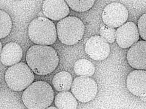 Imagen microscópica de puntos cuánticos (puntos oscuros) encapsulados en partículas de polímero. / (Dr. Mariano Barrado / UPV/EHU)