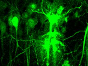 Neuronas hipocampales infectadas con partículas lentivirales que expresan la proteína verde fluorescente para la inactivación del receptor de dopamina D2. / CSIC