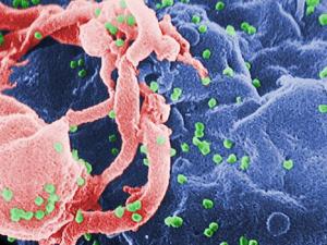Microfotografía con MEB de VIH-1 en liberación (en verde) en un cultivo de linfocitos. Esta imagen ha sido coloreada para resaltar las características importantes; para la imagen original en blanco y negro véase PHIL 1197. Las múltiples protuberancias redondeadas sobre la superficie celular representa los sitios de ensamblado y gemación de viriones. / CDC (WIKIMEDIA)