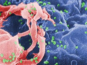 Microfotografía con MEB de VIH-1 en liberación (en verde) en un cultivo de linfocitos. Esta imagen ha sido coloreada para resaltar las características importantes. / CDC/ C. Goldsmith, P. Feorino, E. L. Palmer, W. R. McManus (WIKIMEDIA)