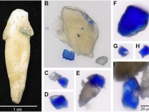 (A)Diente arqueológico del individuo B78 que muestra depósitos de cálculos dentales adjuntos antes del muestreo. (B)Vista de partículas azules incrustadas dentro de una gran pieza de cálculo dental intacto, así como una partícula azul ya liberada del cálculo dental. (C a I)Múltiples partículas azules observadas después de la sonicación del cálculo dental. Tenga en cuenta la frecuente co-ocurrencia de minerales incoloros asociados. / C. Warinner (A); M. Tromp y A. Radini (B a I). (Warinner et al.,2019)