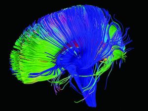 Vías neuronales del cerebro reconstruidas utilizando la tractografía, una técnica para modelar dt-MRI que resalta áreas de actividad y estructura del cerebro. / P. Basser - NICHD (FLICKR, CC BY 2.0)