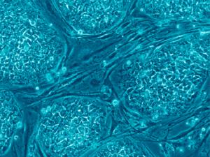 Células madre embrionarias humanas. / Nissim Benvenisty (WIKIMEDIA)
