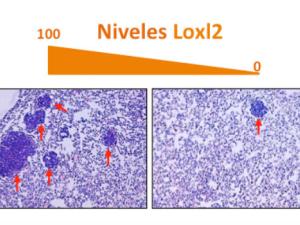 Cortes histológicos de pulmones con metástasis (flechas rojas). Izquierda: metástasis originadas a partir de tumores con niveles normales de Loxl2. Derecha: metástasis producidas a partir de tumores en los que se ha eliminado Loxl2. / UAM