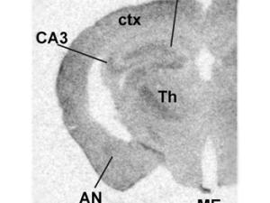 Expresión del gen que codifica la proteína D2 (Dio2) en cerebro de ratón adulto. Clara expresión en corteza cerebral (ctx), núcleo talámico (Th), eminencia media (ME), giro dentado (DG) y zona CA3 del hipocampo (CA3). No se observa en los núcleos de la amígdala (AN). /UAM