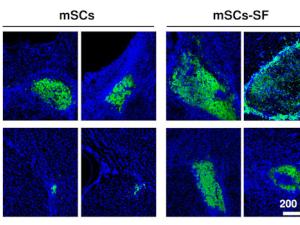 Imágenes de microscopia de fluorescencia mostrando células madre (en verde) injertadas en el tejido cerebral (azul). Los cuatro cuadros de la izquierda muestran la supervivencia de células madre implantadas sin encapsular, y los cuatro de la derecha la de células encapsuladas en hidrogeles de fibroína de la seda. / Front Cell Neurosci. 2018 Sep 6;12:296. doi: 10.3389/fncel.2018.00296 