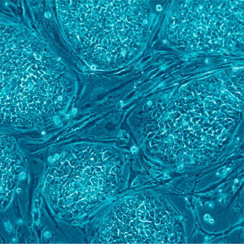 Células madre embrionarias humanas. / Nissim Benvenisty (WIKIMEDIA)