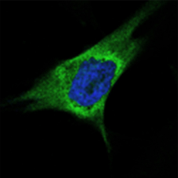 Expresión de LOXL2 en una línea celular de carcinoma de mama de tipo basal,  mostrando la intensa tinción de LOXL2 (verde) rodeando al núcleo (azul). /UAM