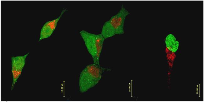 Dinámica mitocondrial en células FT293 con expresión de GFP-TIA1 (izquierda), GFP-TIAR (centro) y GFP-HuR (derecha). Expresión de las proteínas anteriores (en verde) y las mitocondrias (en rojo) teñidas con Mitotracker. Las barras de tamaño representan 10 micrometros.