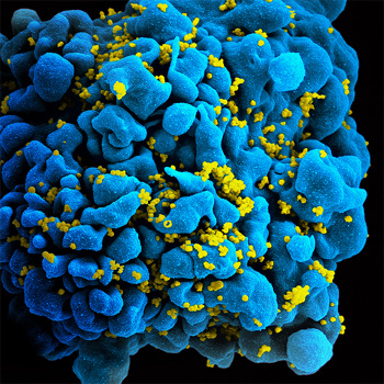Micrografía electrónica de una célula T infectada por VIH. / NIAID (FLICKR)