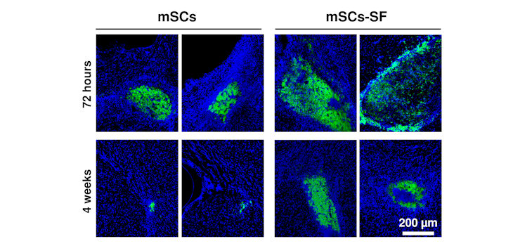 Imágenes de microscopia de fluorescencia mostrando células madre (en verde) injertadas en el tejido cerebral (azul). Los cuatro cuadros de la izquierda muestran la supervivencia de células madre implantadas sin encapsular, y los cuatro de la derecha la de células encapsuladas en hidrogeles de fibroína de la seda. / Front Cell Neurosci. 2018 Sep 6;12:296. doi: 10.3389/fncel.2018.00296 