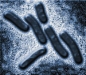o_Mycobacterium_tuberculosis_VISAVET