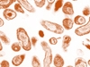 o_coxiella-burnetii