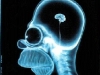 o_CerebroHomer
