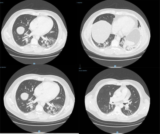 1-s2.0-S0924857920301643-gr3