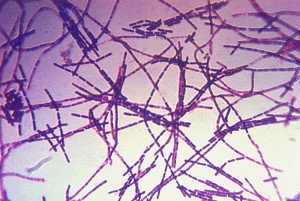 Bacillus anthracis tinción Gram