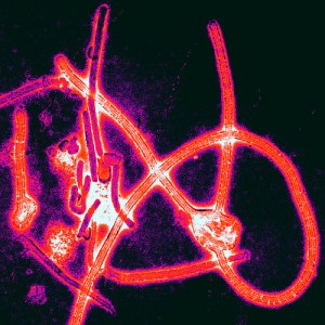 Virus Ébola microscopio electrónico