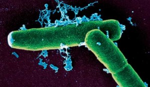 Bacillus antracis