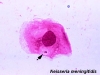 o_Neisseria-meningitidis2