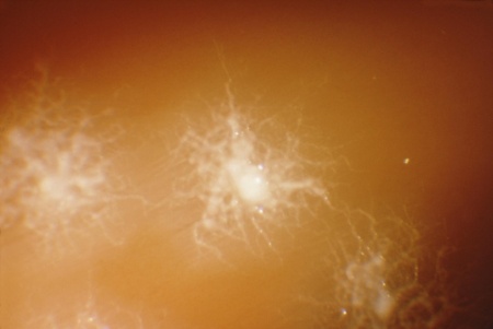 colonias-de-clostridium-sporogenes