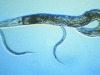 caenorhabditis-elegans-adulto-y-juveniles