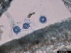 o_esporas pythium