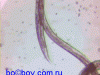 panagrellus-nematodo-de-vida-libre-control-biologico-de-especies