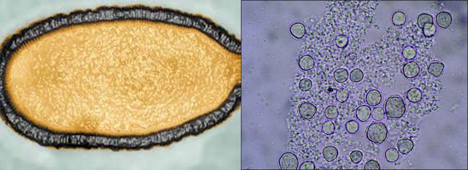 virus-gigante-y-su-ameba-huesped-permafrost